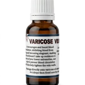 Varicose Veins